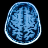 brain